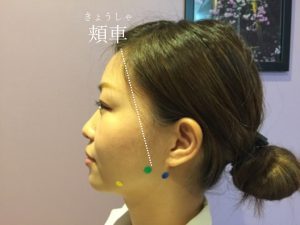 小顔になるツボ押しで 理想のフェイスラインを手に入れる シーバイカリスタ 美容鍼コラム