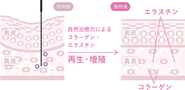 肌の自然治癒力を引き出す