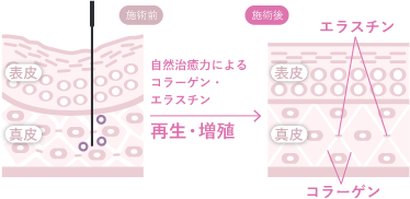 肌の自然治癒力を引き出す