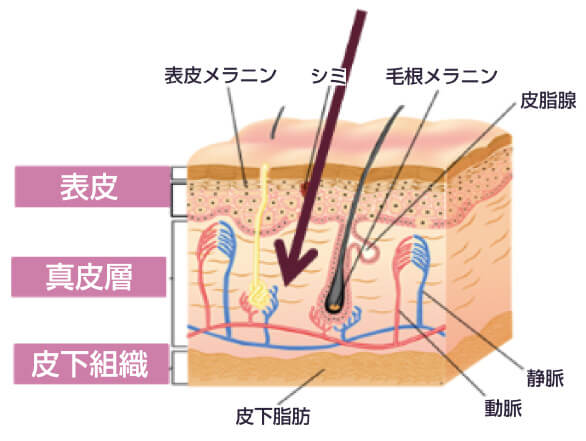 美容鍼は深層にとどく